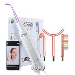 Darsonval High Frequency Acne, Hair Loss, Wrinkle Reduction GESS SuperNova